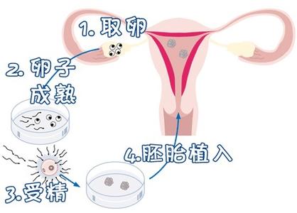 试管供卵代孕公司
